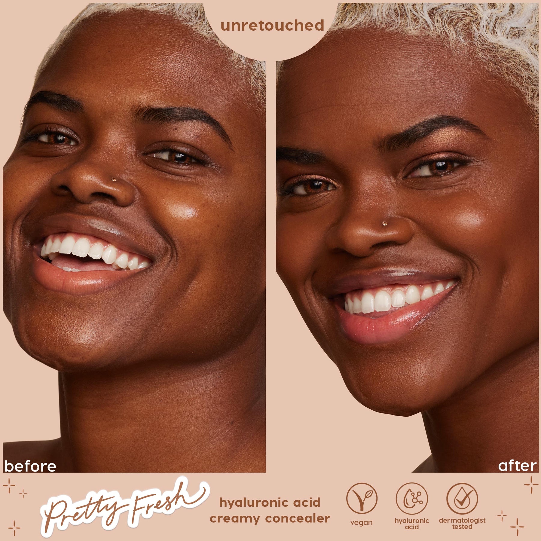 Deep Dark 205 N - Rosy Select Complexion Clarity